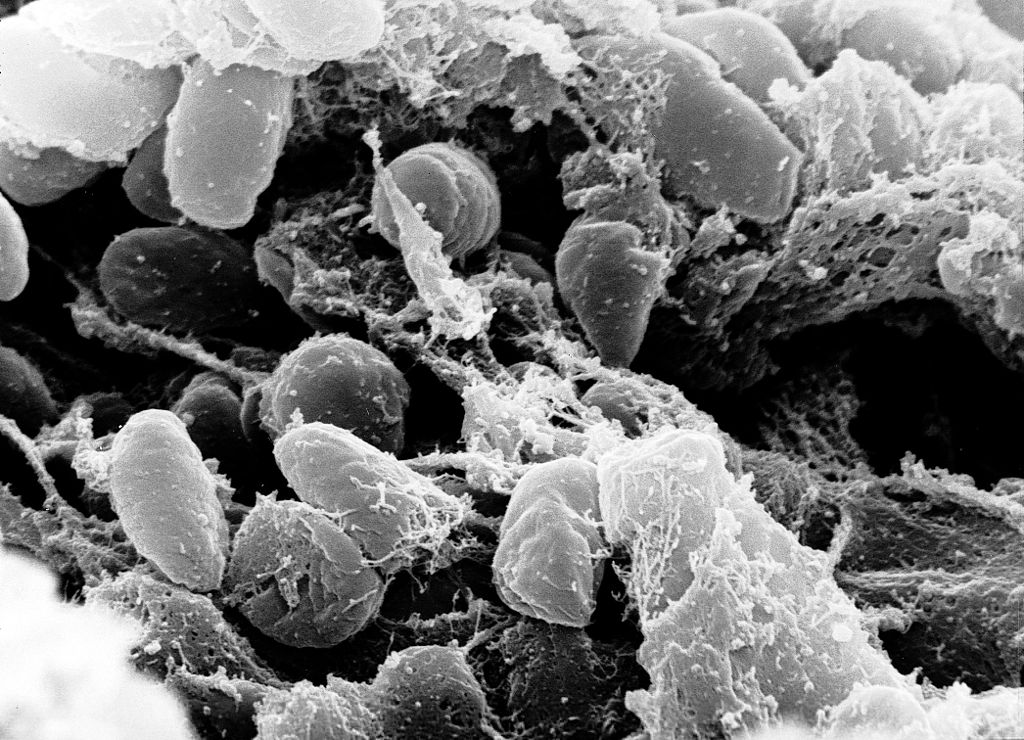 1024px-Yersinia_pestis