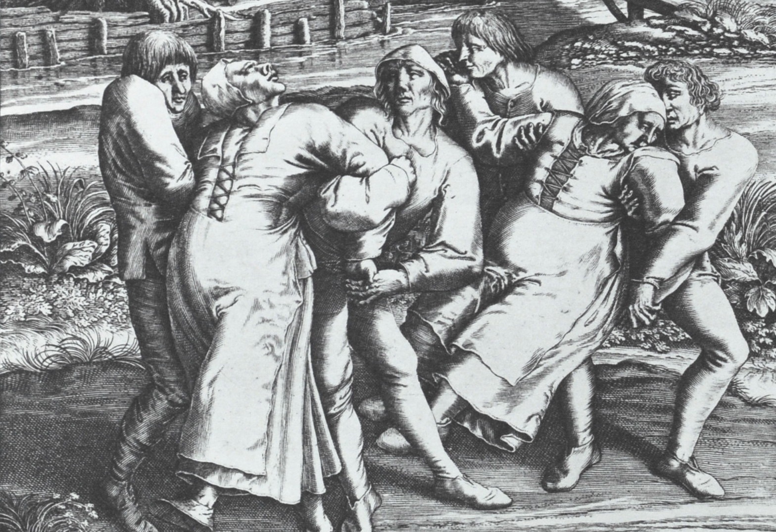 The Dancing Plague of 1518 - Past Medical History