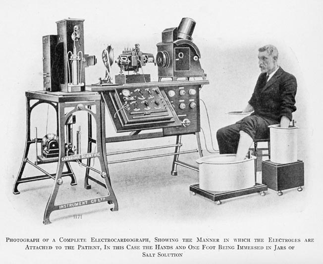 Did You Know ECG Was Invented Over a Century Ago?