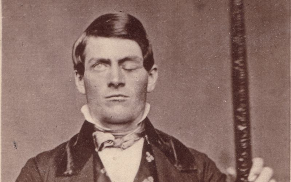 The Frontal Lobe of Phineas Gage