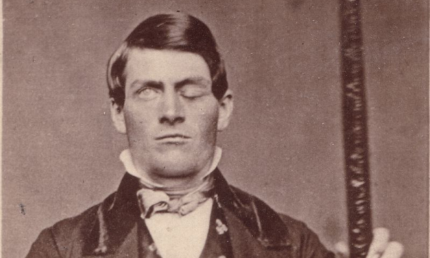 The Frontal Lobe of Phineas Gage
