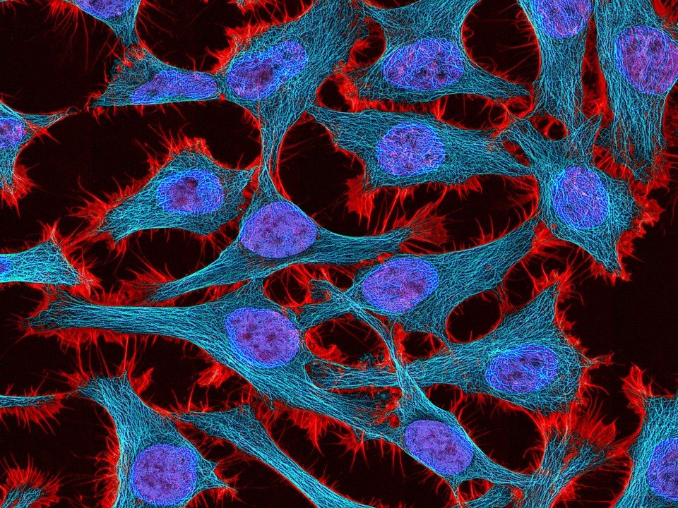 Multiphoton fluorescence image of HeLa cells
