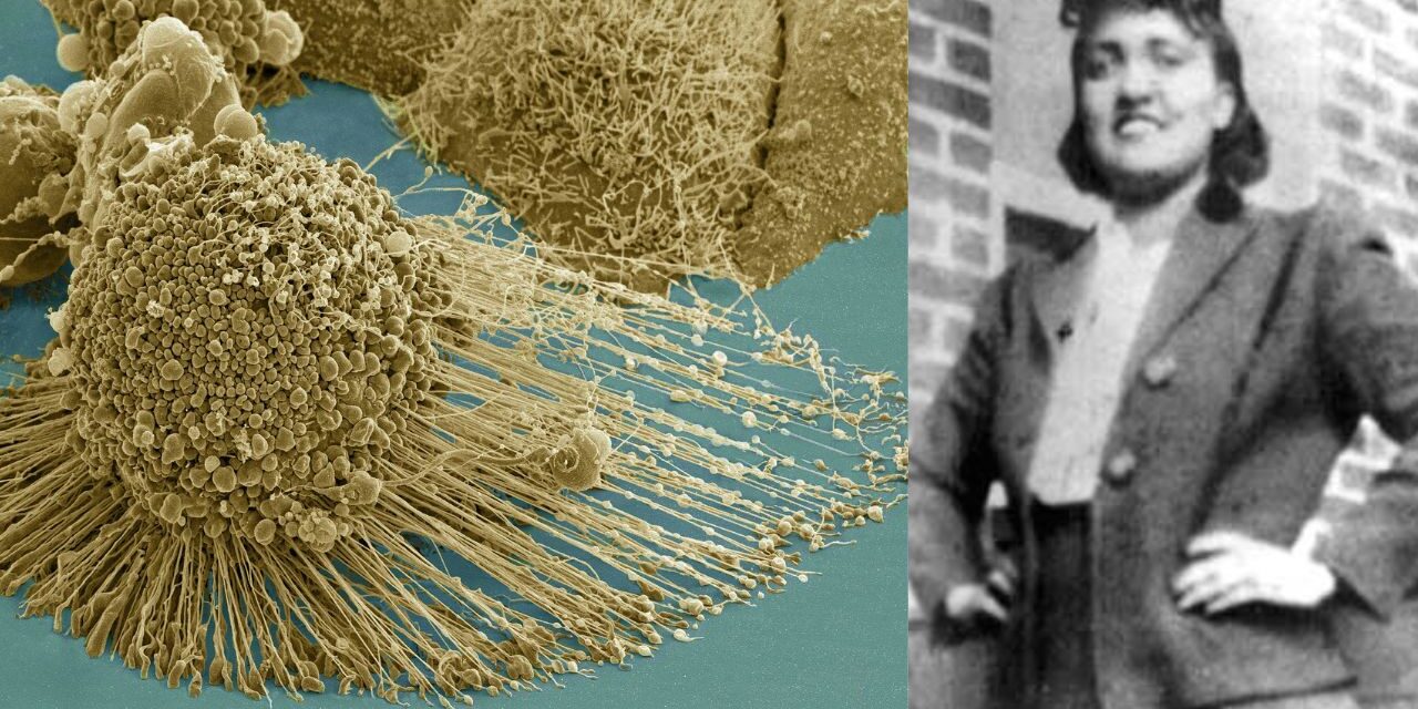 The Immortal cells of Henrietta Lacks