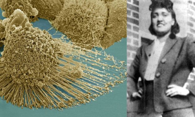 The Immortal cells of Henrietta Lacks